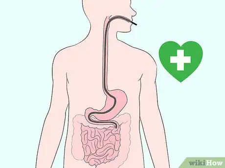 Imagen titulada Test for Lactose Intolerance Step 11