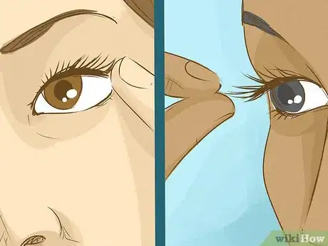 Imagen titulada Get an Eyelash Out of Your Eye Step 7