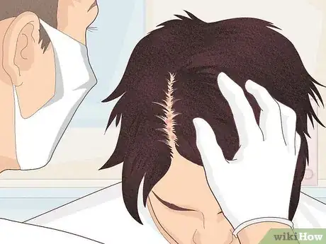 Imagen titulada Bumps on Scalp Step 15