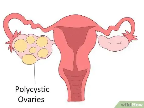 Imagen titulada Lower Testosterone Levels Step 13