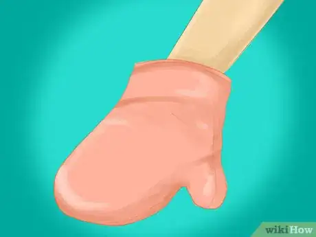 Imagen titulada Relieve Blister Pain Step 14