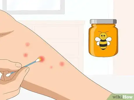 Imagen titulada Heal Mosquito Bites Fast Step 5