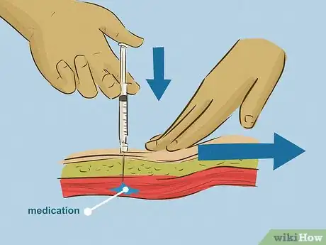 Imagen titulada Give an Intramuscular Injection Step 17