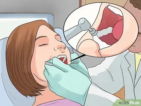 Imagen titulada Determine if a Tooth Needs to Be Pulled Step 15