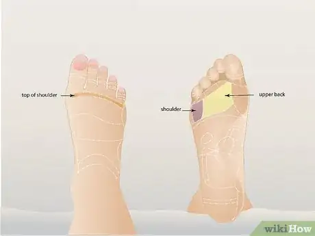 Imagen titulada Relieve Back Pain Through Reflexology Step 3