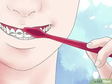 Imagen titulada Fix Crooked Teeth Step 22