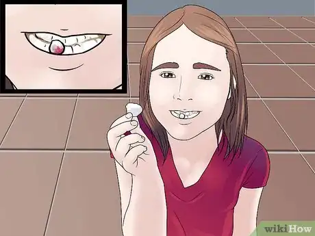 Imagen titulada Stop the Bleeding After You Pull out a Loose Tooth Step 9