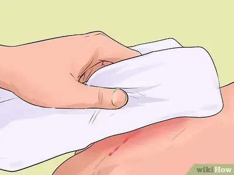 Imagen titulada Treat Severe Bleeding During First Aid Step 5