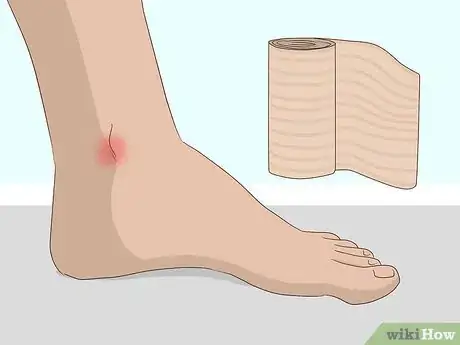 Imagen titulada Wrap an Ankle with an ACE Bandage Step 9