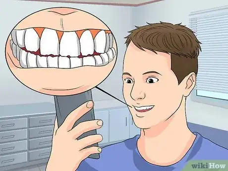 Imagen titulada Recognize Tooth Enamel Loss Step 3