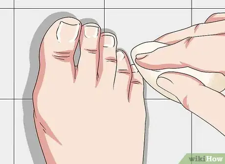 Imagen titulada Do a Self Pedicure Step 15