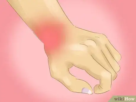 Imagen titulada Relieve Wrist Pain Step 7