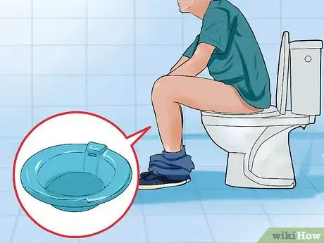 Imagen titulada Stop Hemorrhoids from Itching Step 1