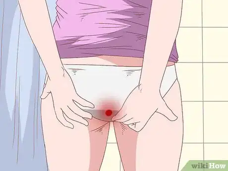 Imagen titulada Care for Hemorrhoids Postpartum Step 3