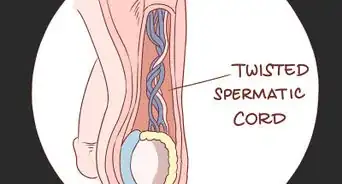 tratar el dolor y la hinchazón en los testículos