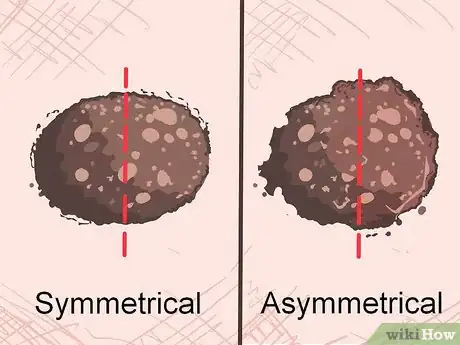 Imagen titulada Recognize Melanoma Step 1