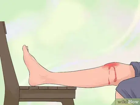 Imagen titulada Treat Severe Bleeding During First Aid Step 7