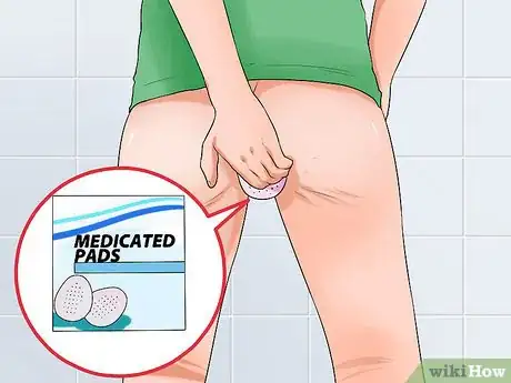 Imagen titulada Stop Hemorrhoids from Itching Step 3