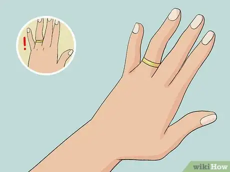 Imagen titulada Get Rid of Chubby Hands Step 2