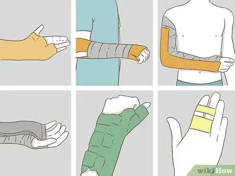 Imagen titulada Apply Splints Step 10