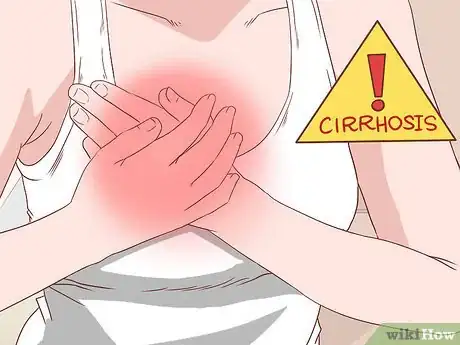 Imagen titulada Recognize Cirrhosis Step 5