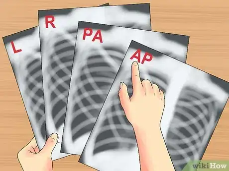 Imagen titulada Read a Chest X Ray Step 7