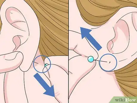 Imagen titulada Remove Earrings for the First Time Step 5