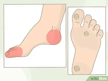 Imagen titulada Get Healthy, Clean and Good Looking Feet Step 13