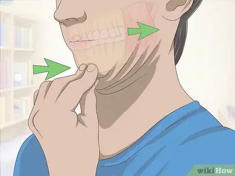 Imagen titulada Treat Temporomandibular Joint Disorder (TMD) with Jaw Exercises Step 3