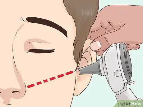 Imagen titulada Use an Otoscope Step 8