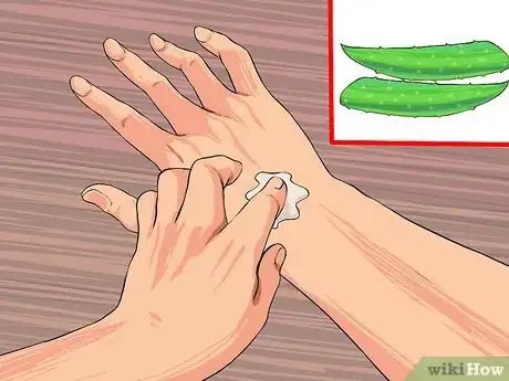 Imagen titulada Grow and Use Aloe Vera for Medicinal Purposes Step 11