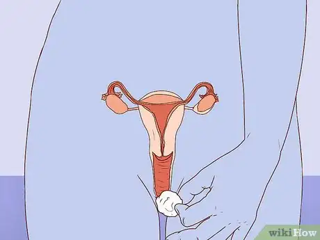 Imagen titulada Balance Vaginal pH Step 8