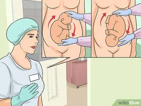 Imagen titulada Avoid a Cesarean Section Step 12