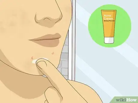 Imagen titulada Get Rid of Dark Spots on Your Face Step 10