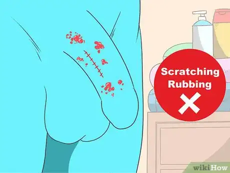 Imagen titulada Get Rid of Genital Warts Step 12