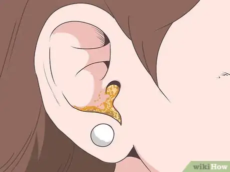 Imagen titulada Tell if You Have an Ear Infection Step 2