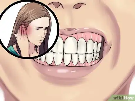 Imagen titulada Reduce Jaw Pain Step 1