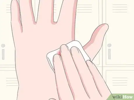 Imagen titulada Stop Warts from Bleeding Step 1