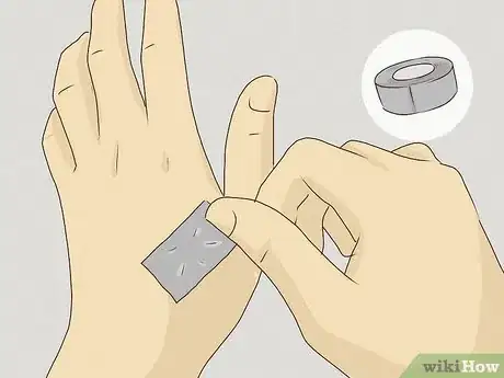 Imagen titulada Treat a Wart at Home Step 5