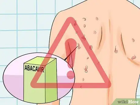 Imagen titulada Identify an HIV Rash Step 4