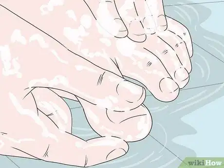 Imagen titulada Remove Splinters from Feet Step 7