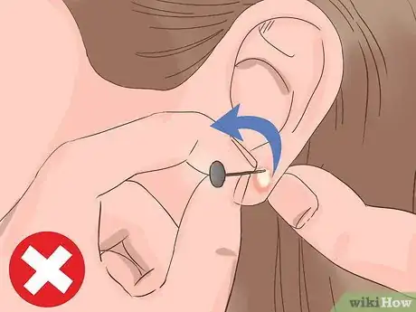 Imagen titulada Treat an Infected Ear Piercing Step 2