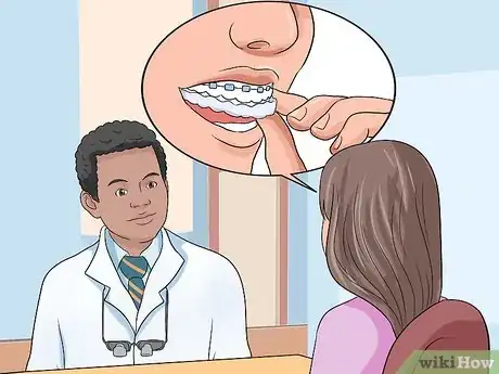Imagen titulada Choose the Color of Your Braces Step 10