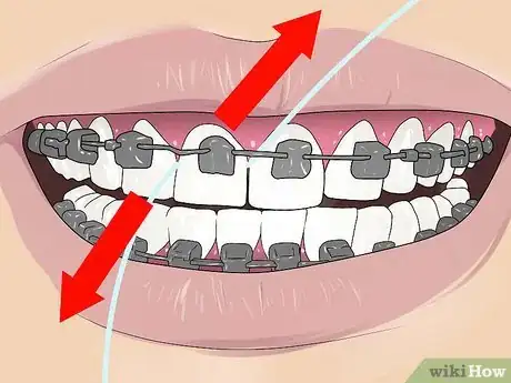 Imagen titulada Floss With Braces Step 4