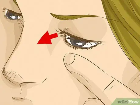 Imagen titulada Get an Eyelash Out of Your Eye Step 5