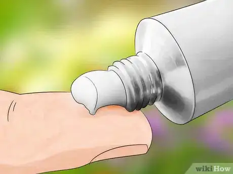 Imagen titulada Get Bug Bites to Stop Itching Step 10