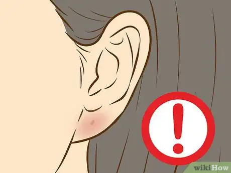 Imagen titulada Get Your Ears Pierced Step 17