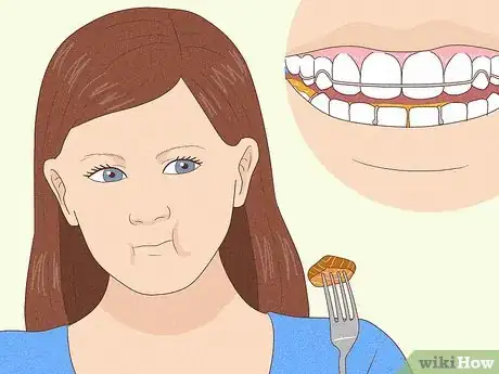 Imagen titulada Cope with Twin Block Braces Step 3