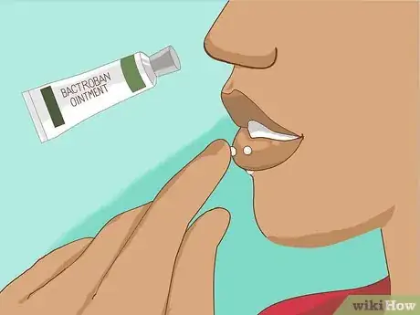 Imagen titulada Treat an Infected Lip Piercing Step 8