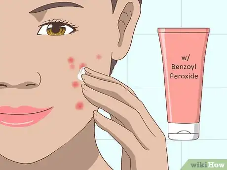 Imagen titulada Prevent Oily Skin Step 6